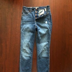 Madewell 10” High-Rise Skinny Ankle Jeans